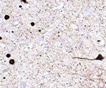 Conformation-Specific Alpha-Synuclein Antibody for Parkinson’s Disease