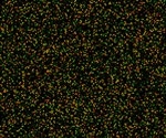 Serial Analysis of Gene Expression (SAGE) and DNA Microarray Compared