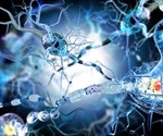 Transition Between Relapsing-Remitting MS and Secondary-Progressive MS