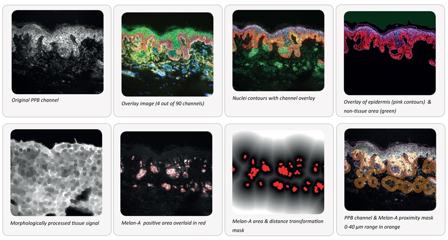 quantifiedantigens