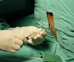 Relapsing-Remitting Multiple Sclerosis Diagnosis