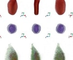 What is Holotomography?