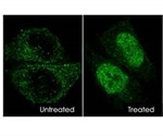 A Short Overview of Hypoxia Markers