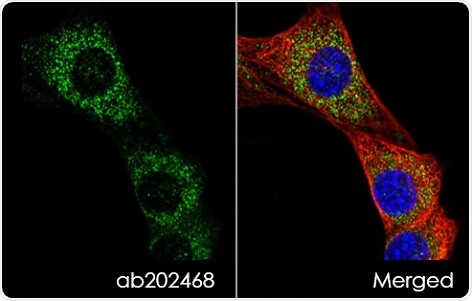 PDK1 staining of NIH/3T3 cells. Anti-mitochondrial pyruvate dehydrogenase kinase 1 antibody (ab202468) was used at a dilution of 1/1000 with goat anti-rabbit IgG (Alexa Fluor 488) secondary antibody (ab150077). Cells were counterstained with DAPI (blue) and tubulin also stained (red).