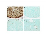 TUNEL Staining: An Overview
