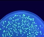 Single Particle Tracking in Biology