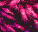 Wide-field Fluorescence Microscopy