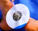 What is Negative Pressure Wound Therapy?
