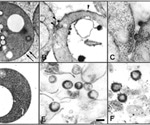 What are Spheroplasts?