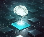 Deep-Learning in Radiology