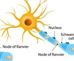 Small Fiber Neuropathy Diagnosis and Treatment