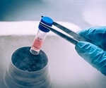 Stem Cell Differentiation in the Colon
