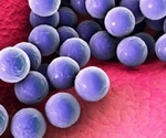 Difference Between Spheroplasts and Protoplasts