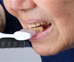 Tooth Erosion Causes