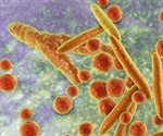 Intestinal Mycoplasma and Crohn's Disease