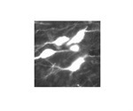 Neuron Markers for Serotonergic Neurons