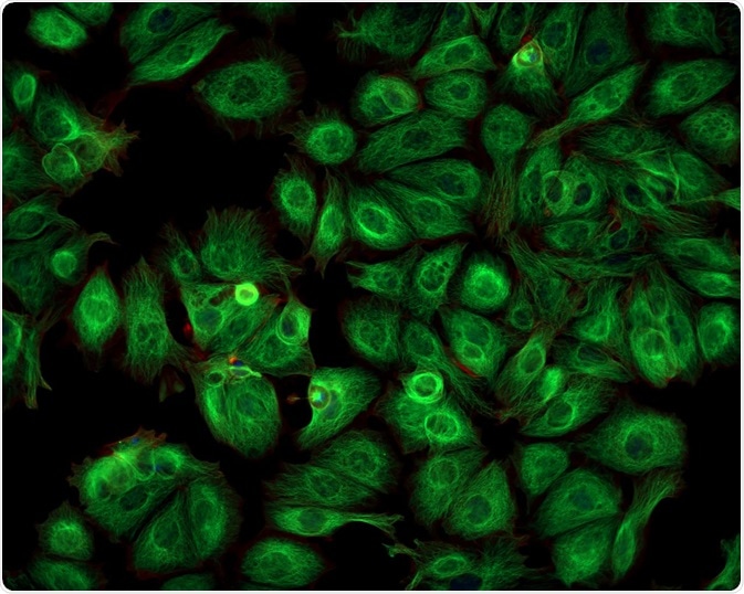 Cancer cells illuminated by fluorescence microscopy - By Caleb Foster Cancer cells illuminated by fluorescence microscopy - By Caleb Foster