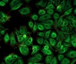 Total Internal Reflection Fluorescence (TIRF) Microscopy Applications