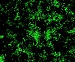 TIRF Microscopy Explained