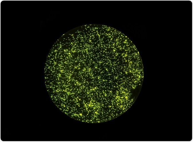 Fluorescent bacterial cells - By Jeerasak Meeraka Fluorescent bacterial cells - By Jeerasak Meeraka