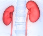 Life After a Kidney Transplant