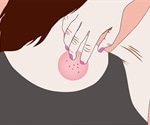 Ringworm Diagnosis