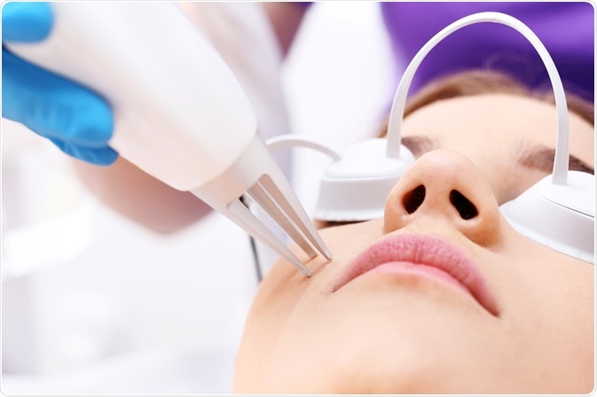 Dermabrasian - a treatment for acne - By Robert Przybysz