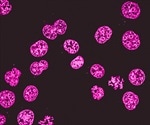 Fluorescence Microscopy vs. Light Microscopy