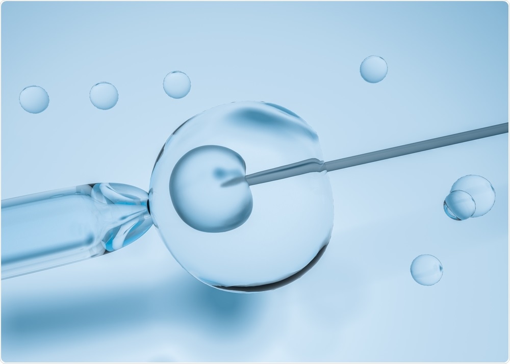 IVF - By vchal