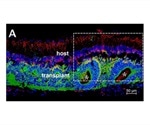 Retinal sheet transplants restore vision in blind rats