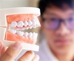 What Foods Are Bad for Your Teeth and Mouth?