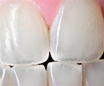 What Are Teeth Made Of?