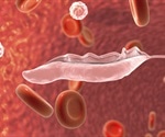 African Sleeping Sickness Causes