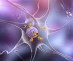 Parkinson's Compared to Dementia with Lewy Bodies (DLB)