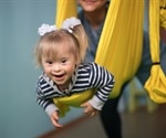 Down Syndrome Symptoms