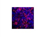 How to Find the Correct Markers to Label Neuroepithelial Cells