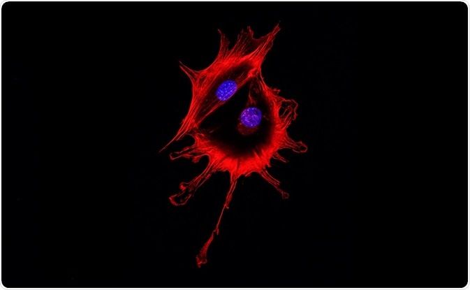 Cell visualized using fluorescence microscopy - two cells stuck together have to be removed using gating. By DrimaFilm Cell visualized using fluorescence microscopy - two cells stuck together have to be removed using gating. By DrimaFilm