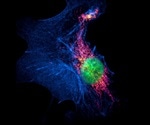 Single-Molecule Localization Microscopy Uses in Research