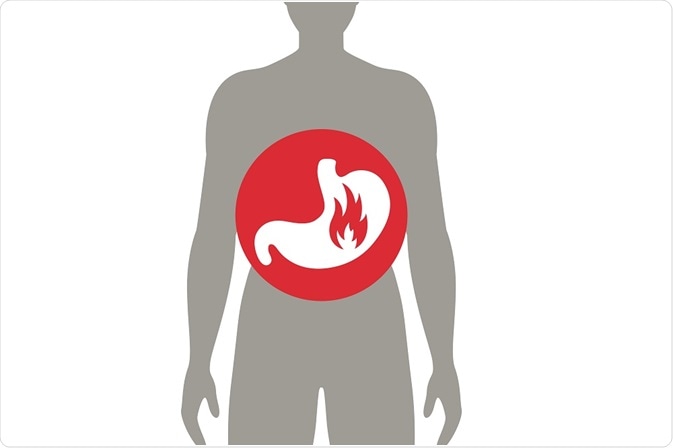 stomach pain and gastritis - illustration - By Ramona Kaulitzki stomach pain and gastritis - illustration - By Ramona Kaulitzki