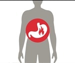 What is Gastritis?