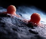 What are Carcinomas?