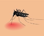 Tungiasis Skin Condition (Jigger)