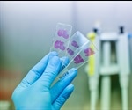 Artificial Intelligence in Histopathology