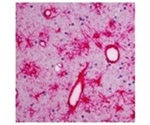 The Functions of Radial Glia Cell Markers