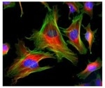 Studying the Dynamics and Function of Microtubules to Understand the Tubulin Code