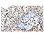 A Flexible and Customized Approach to Achieve Vimentin Research Goals