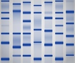 Study highlights the link between urinary and vaginal pathogenic E. coli in recurrent cystitis