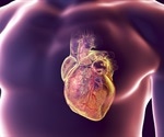 High-performance computing sheds light on heart rhythm disorders
