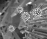 Serial Block Face Scanning Electron Microscopy