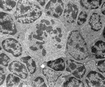 Cryo-electron Tomography Applications